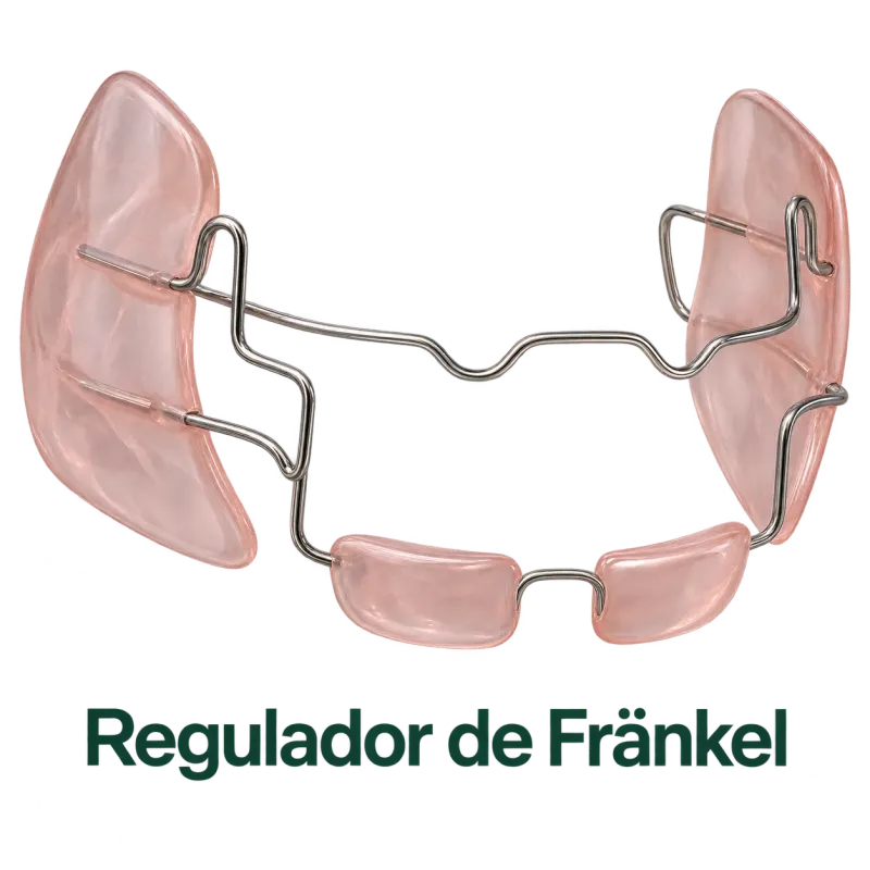 Fränkel regulator appliance