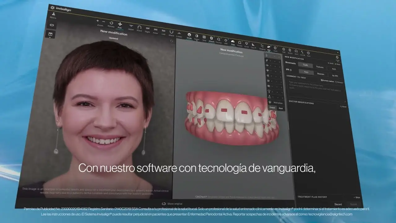 Video: cómo funciona el tratamiento con alineadores invisibles Invisalign